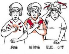 冠心病有哪些癥狀？